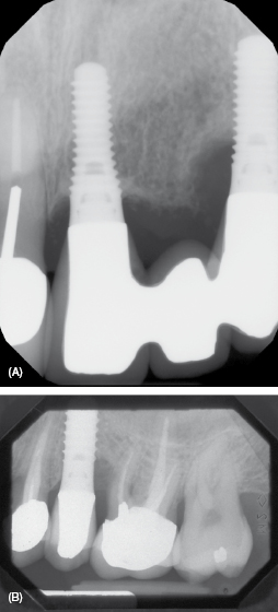 c9-fig-0005