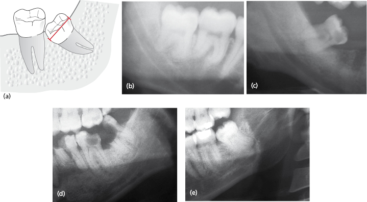 c9-fig-0005