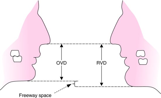 5-jaw-relations-theoretical-considerations-pocket-dentistry