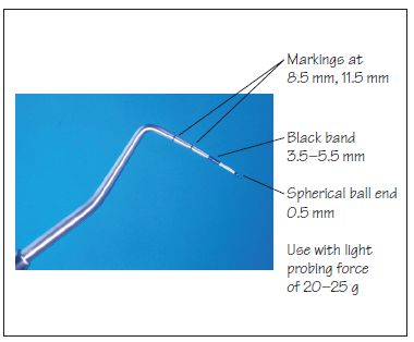 periodontal probe markings
