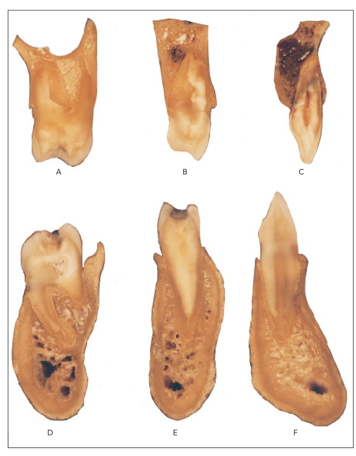 ALVEOLAR BONE Pocket Dentistry