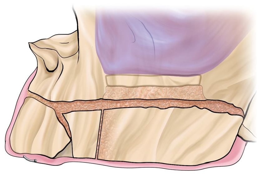 maxillary alveolar