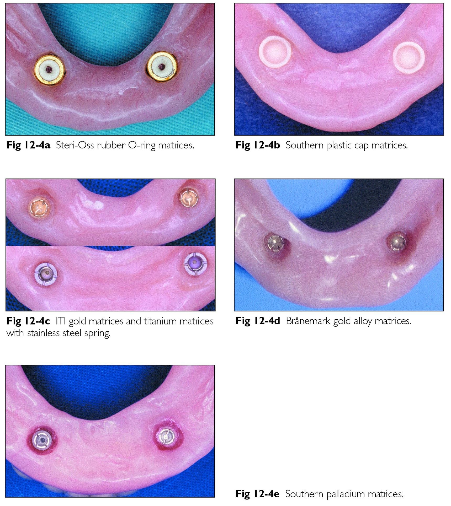 O-ring type of mini implants (Dentis, Daegu, Korea). A: ∅2.0 mm, B:... |  Download Scientific Diagram