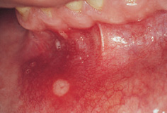 15. Oral Pathology and oral surgery | Pocket Dentistry