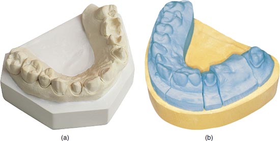 12 Gypsum Materials Pocket Dentistry