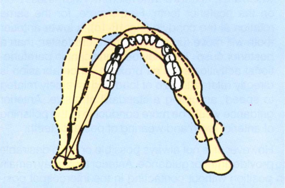 fig16-1c.jpg