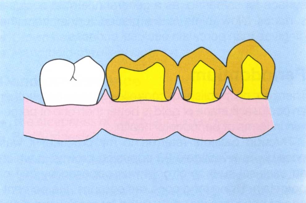 fig17-1b.jpg