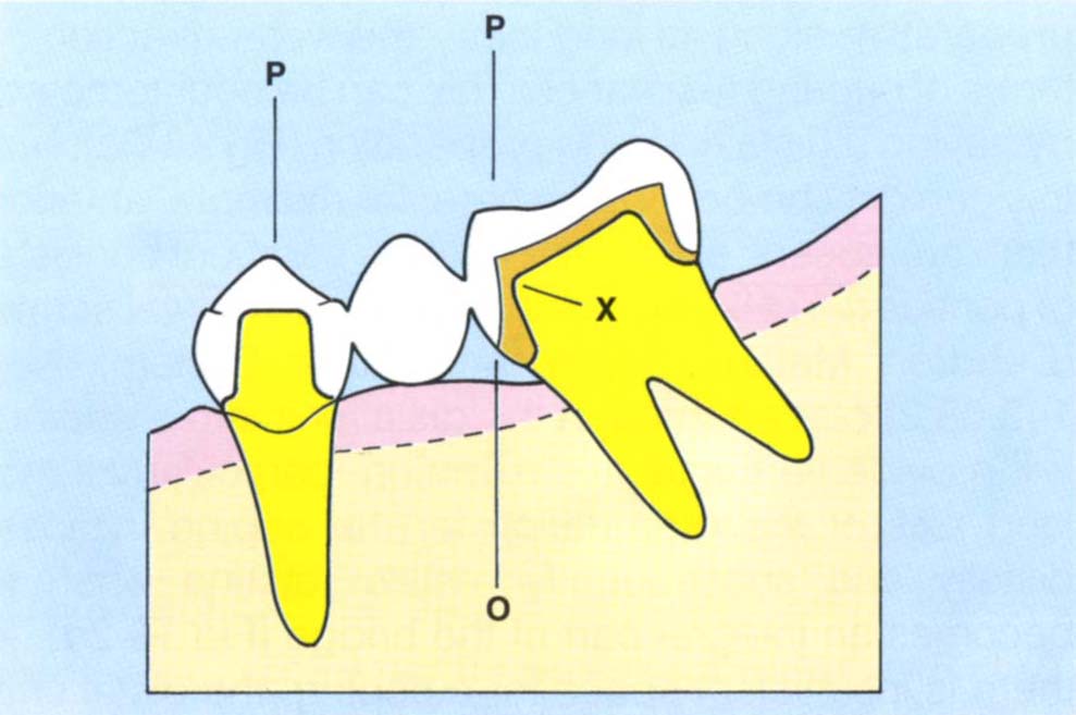 fig18-1e.jpg