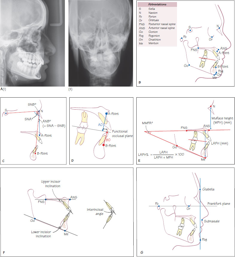 thesis on cephalometric analysis