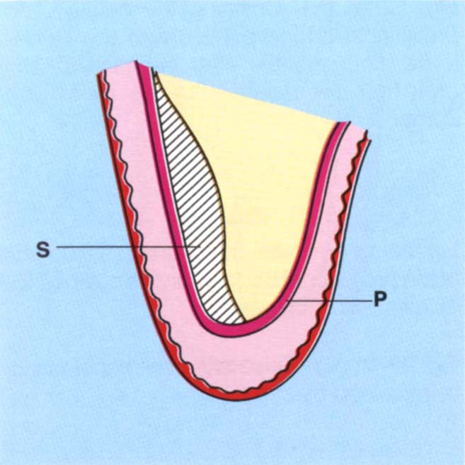 fig22-1g1.jpg