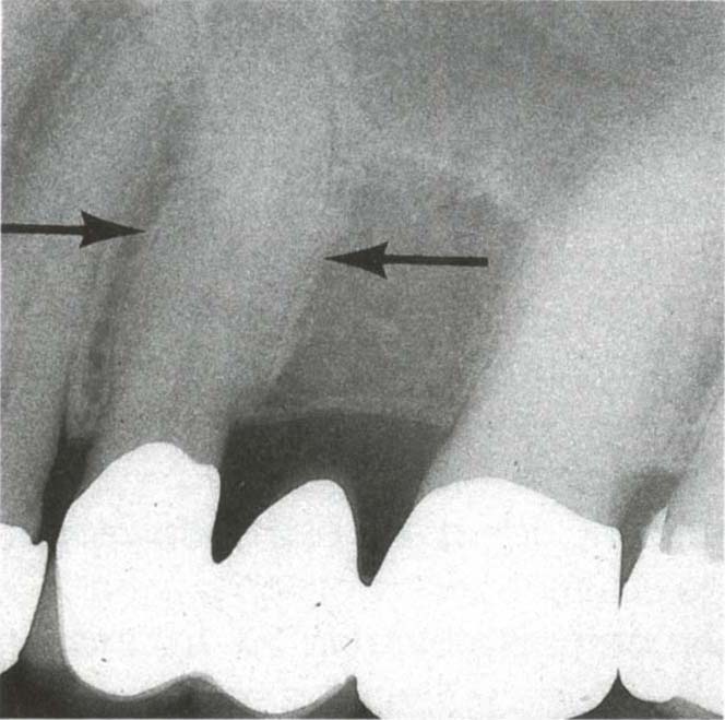 fig23-1a.jpg