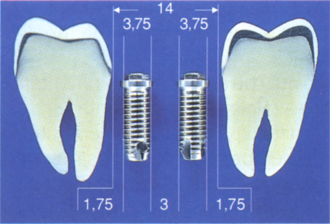 fig33-4a.jpg