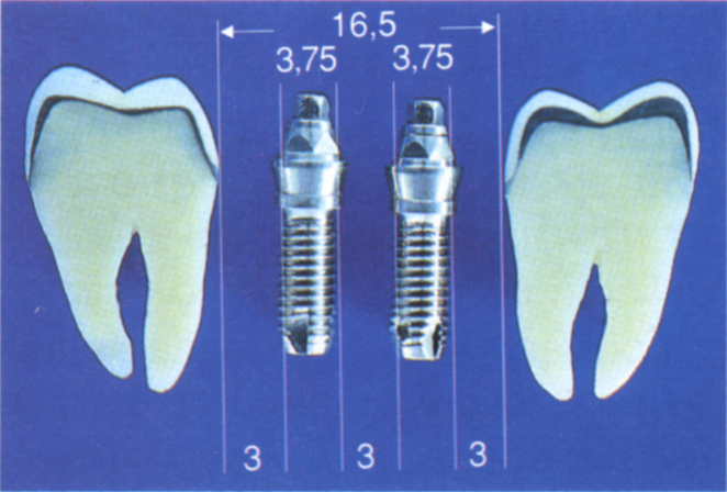 fig33-4b.jpg