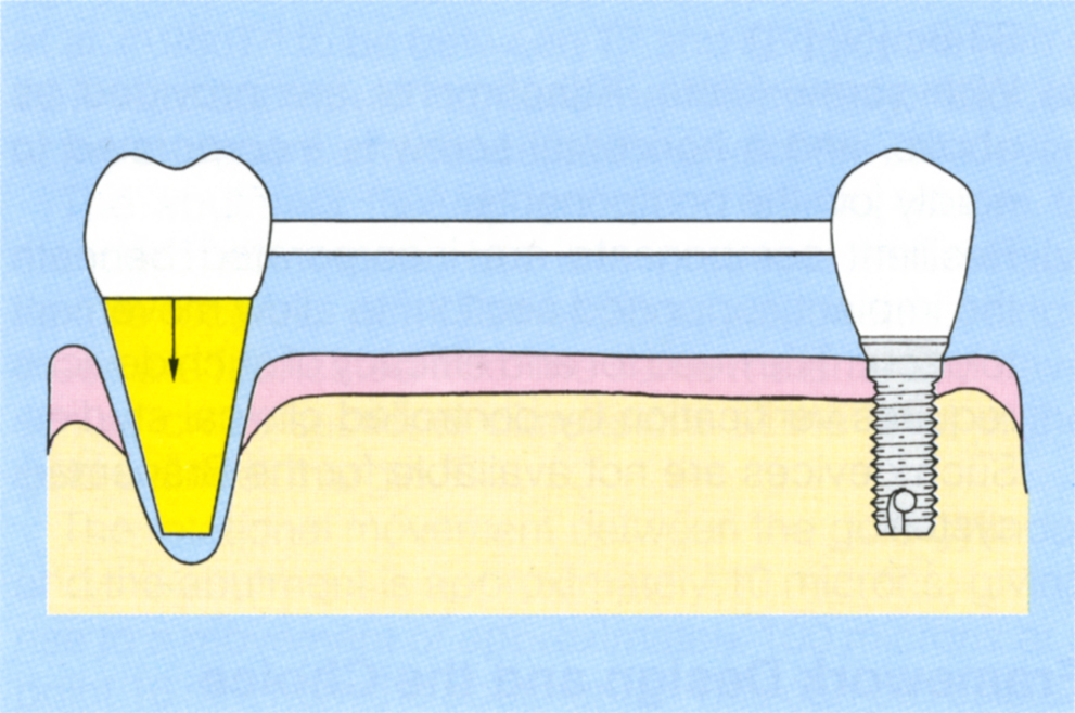 fig33-8b1.jpg