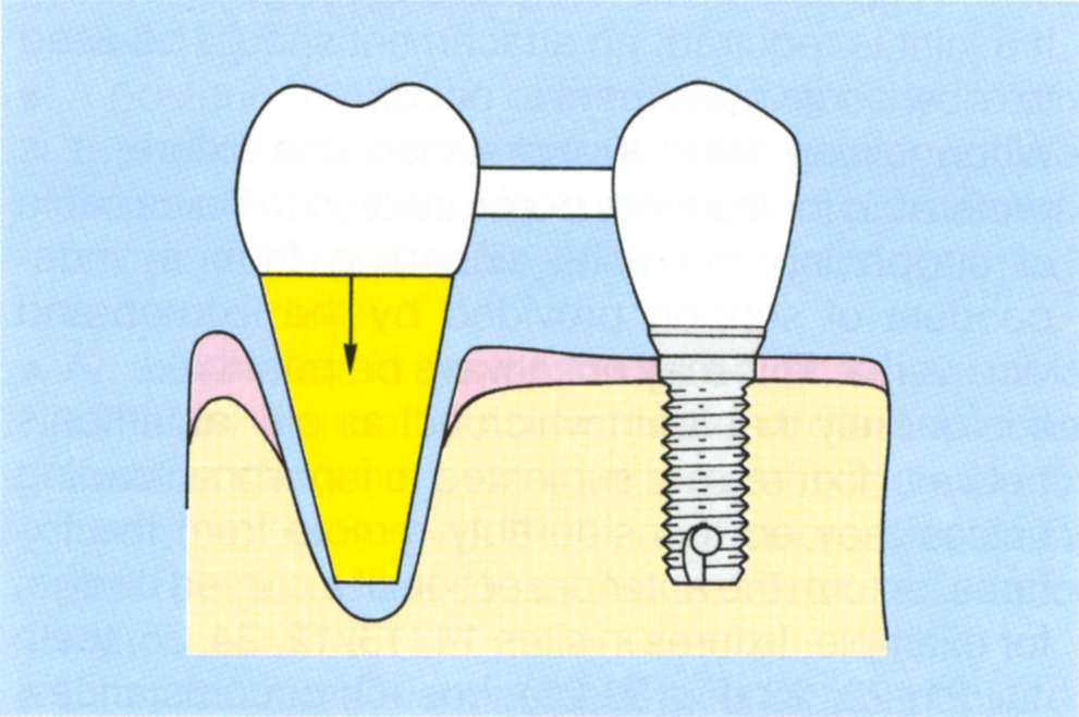 fig33-8b2.jpg