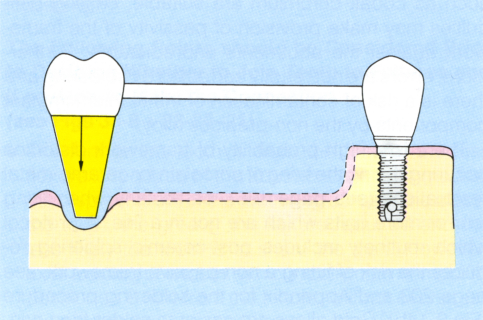 fig33-8b3.jpg