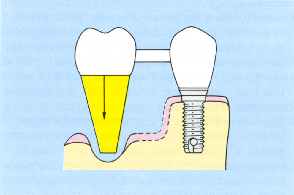 fig33-8b4.jpg