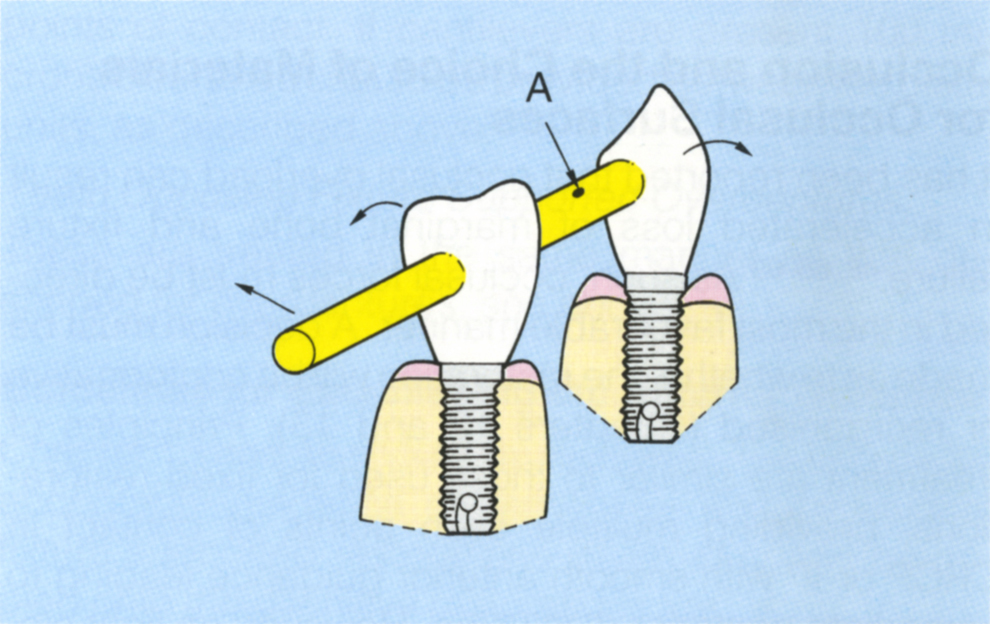 fig33-8c3.jpg