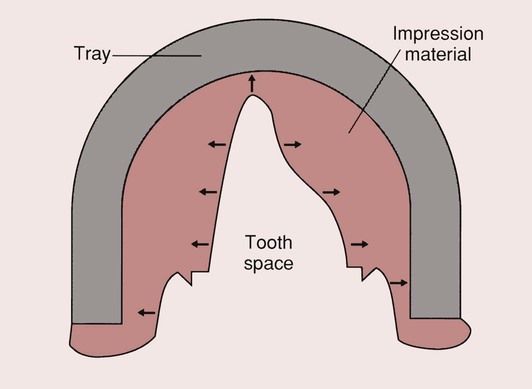 Impression Materials – Non-elastic – My Dental Technology Notes