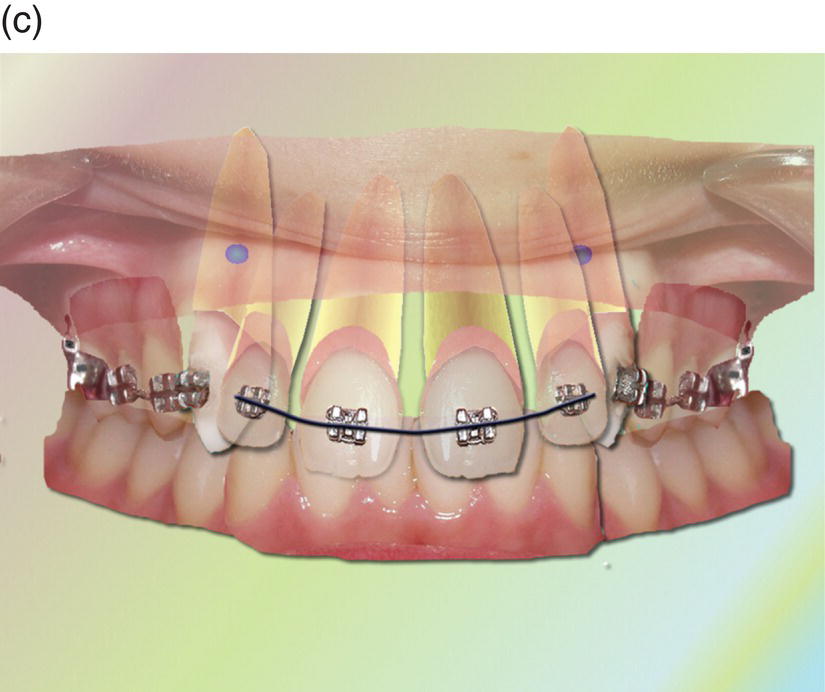 Growth And Development Pocket Dentistry