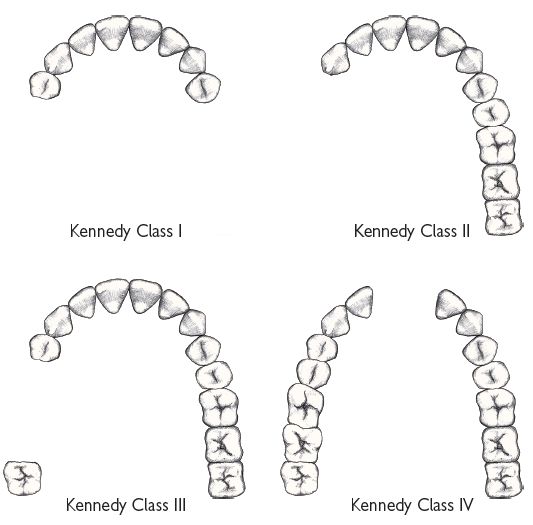 7 Prosthetics and gerodontology Pocket Dentistry