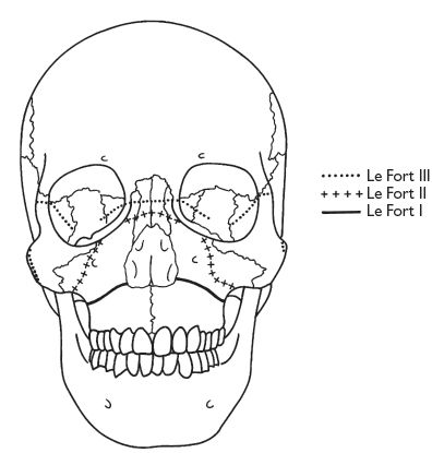 10 Maxillofacial surgery | Pocket Dentistry