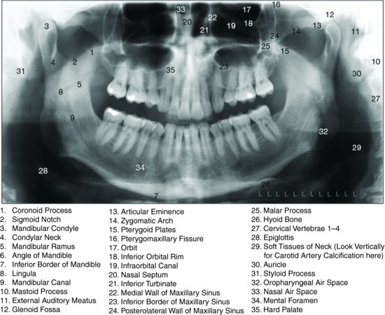 Radiology And The Dental Emergency Clinic Pocket Dentistry