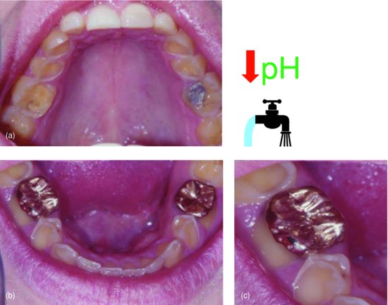 ch04fig001.eps