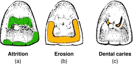 ch04fig003.eps