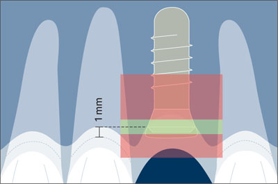 sac_fig013d.jpg