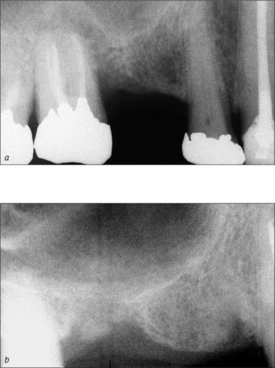 tg3_fig025b.jpg