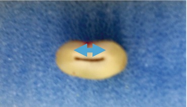 A302171_1_En_5_Fig6_HTML.jpg